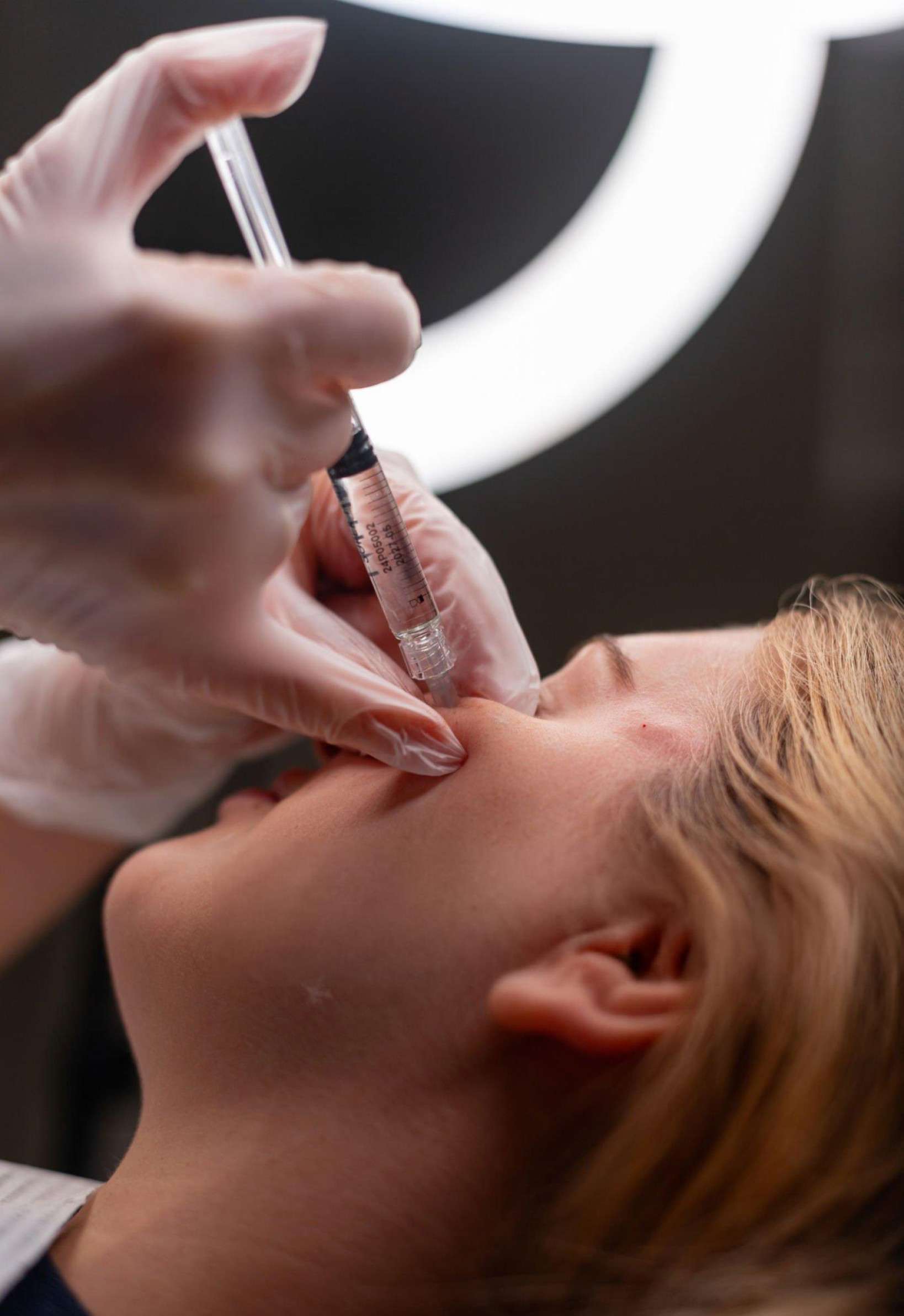 Professional Profhilo treatment being administered